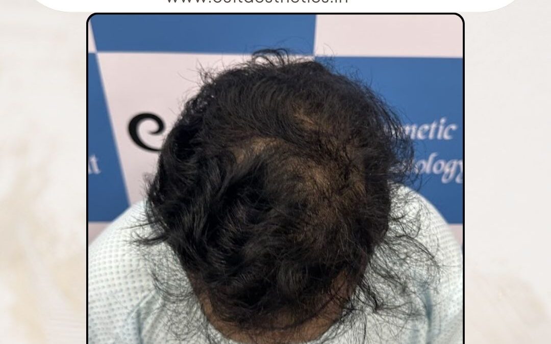 Hair Case 332 Before 4