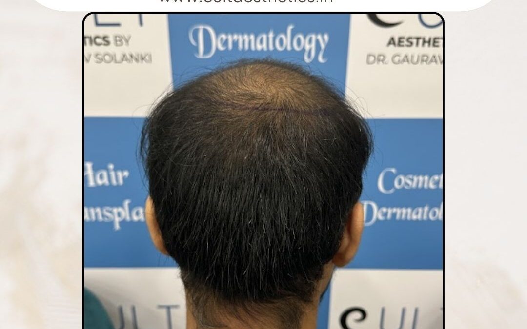 Hair Case 353Before 4