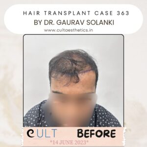 Hair case 363 Before-1