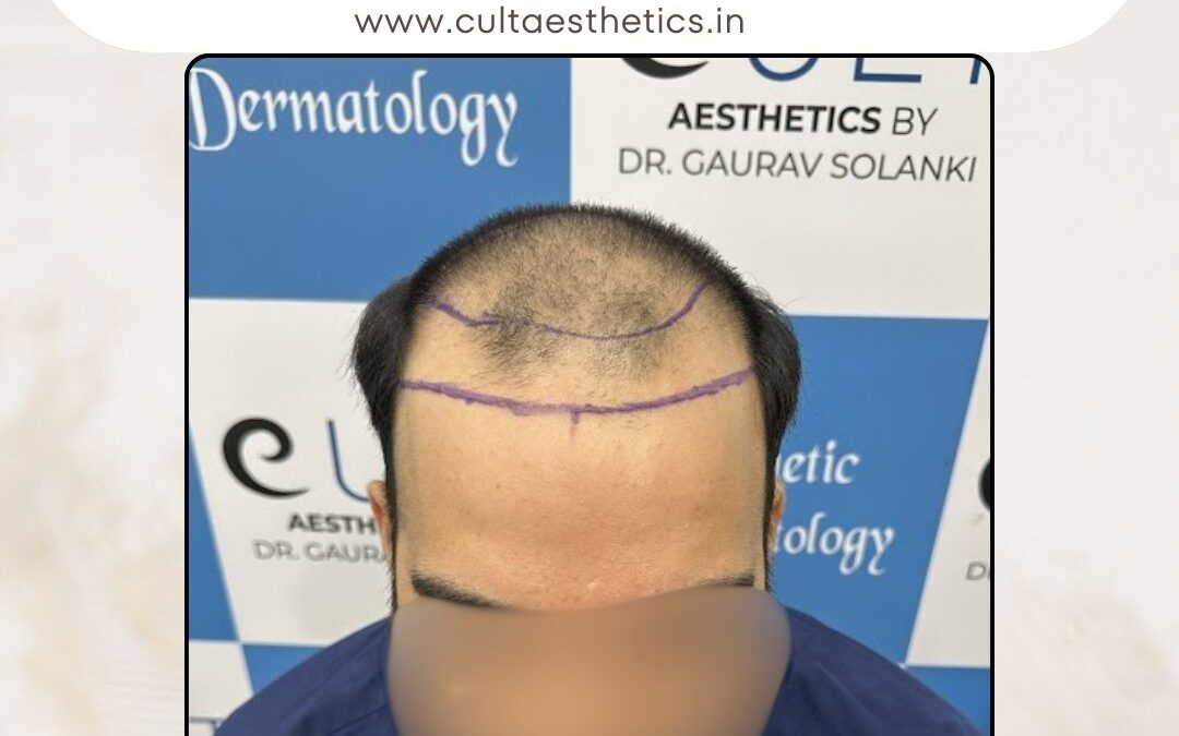 Hair Case 364 Before 1