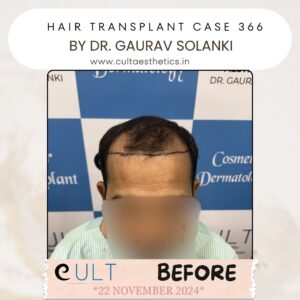 Hair case 366 Before-1