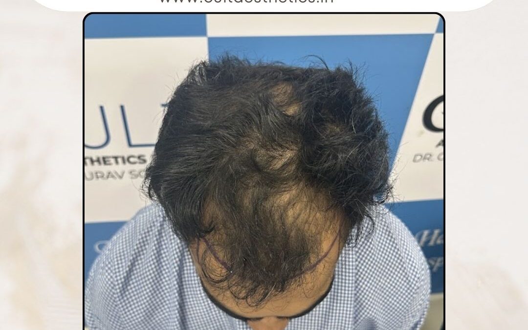 Hair Case 355 Before 4