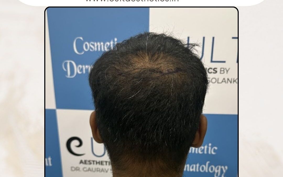 Hair Case 362 Before 4