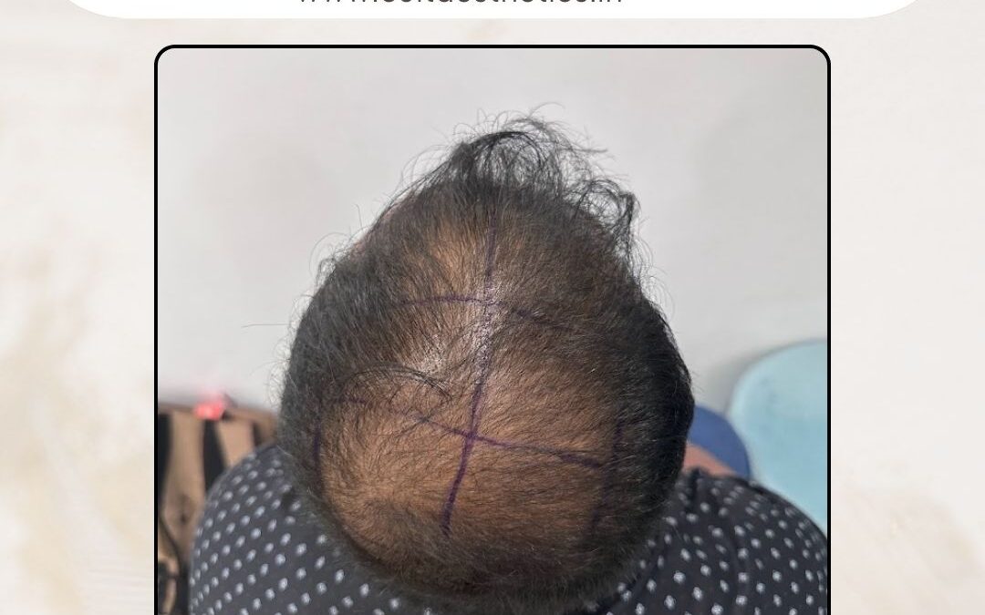 Hair Case 363 Before 3