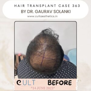 hair case 363 Before-3