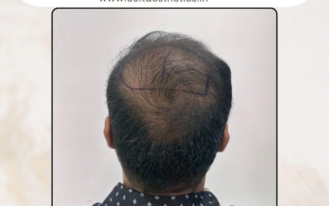 Hair Case 363 Before 4