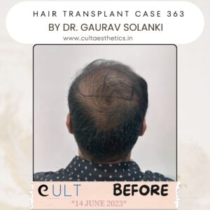 hair case 363 Before-4