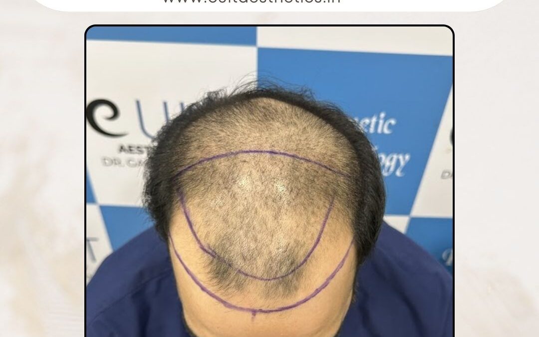 Hair Case 364 Before 2