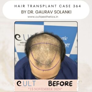 hair case 364 Before-2