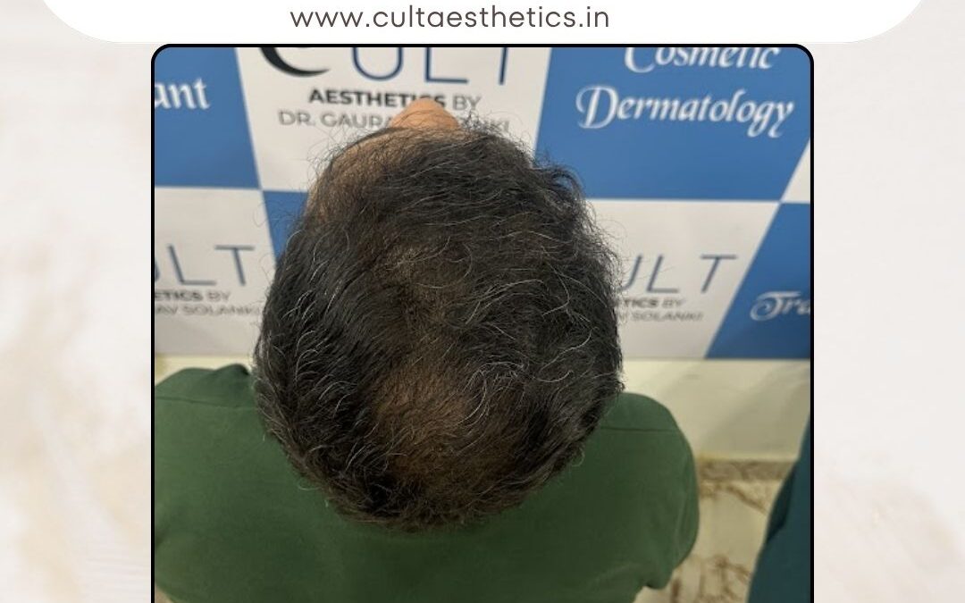 Hair Case 366 After 3