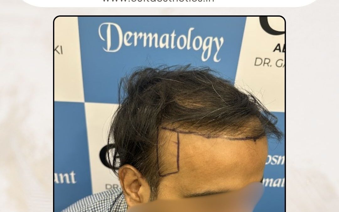 Hair Case 367 Before 2