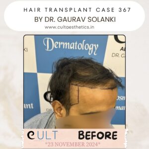 hair case 367 Before-2