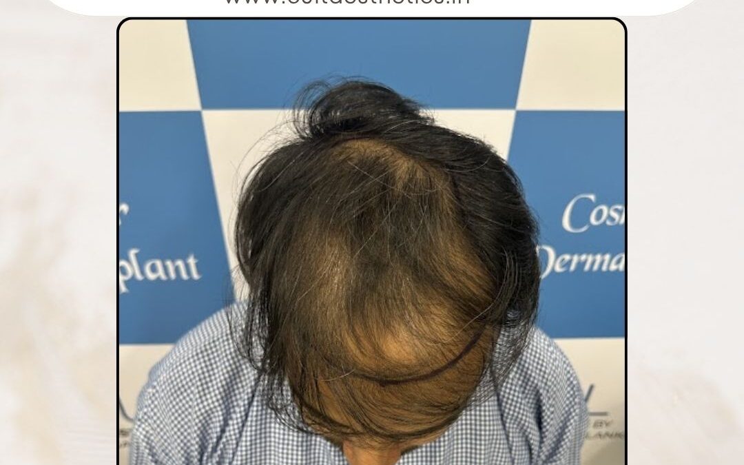 Hair Case 367 Before 4