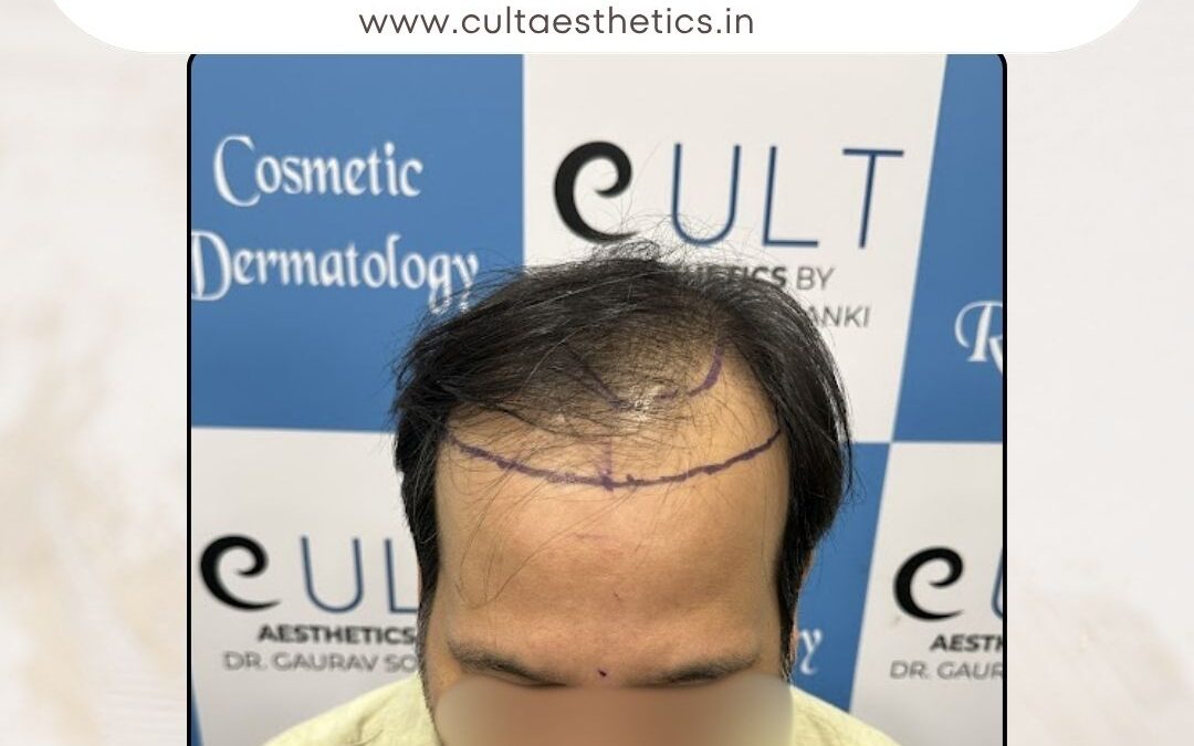 Hair Case 369 Before 1