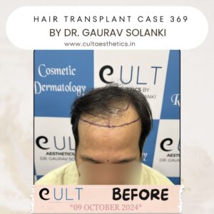 Hair case 369 Before-1