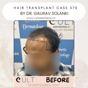 Hair case 370Before-1