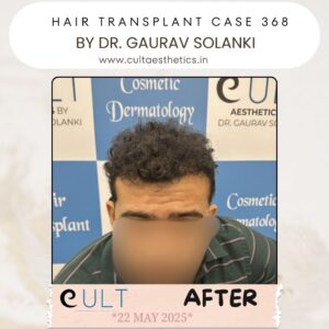 hair case 368 After-1
