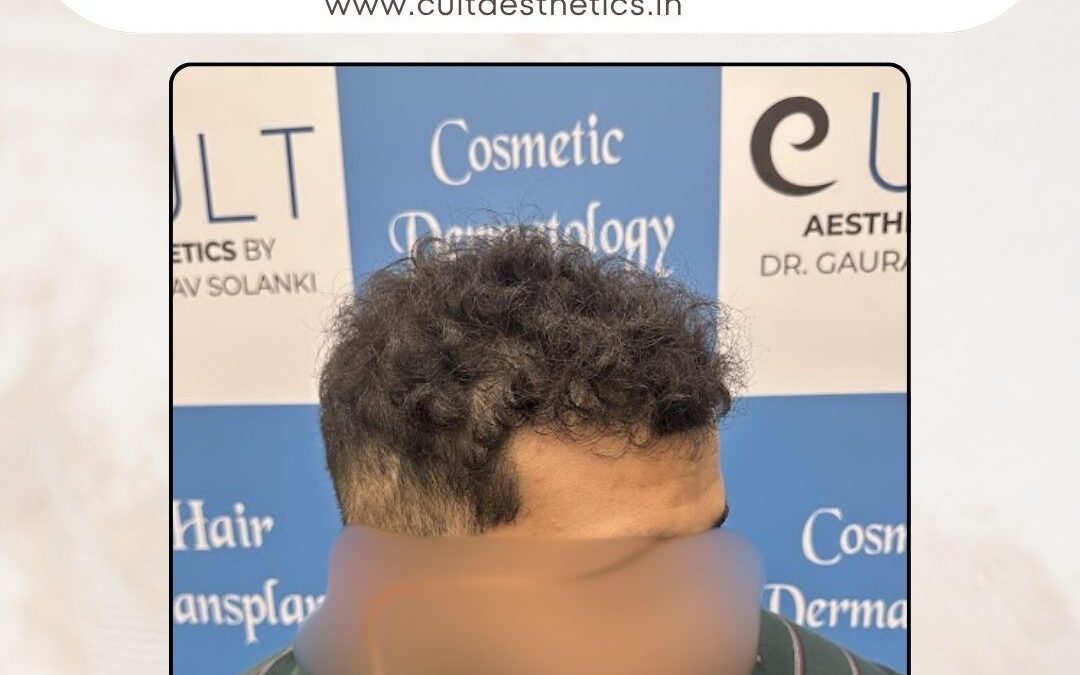 Hair Case 368 After 4