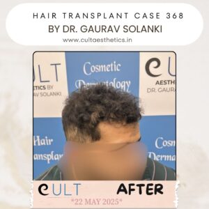 hair case 368 After-4