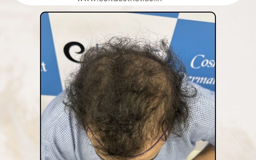 Hair Case 368 Before 2