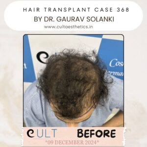 hair case 368 Before-2