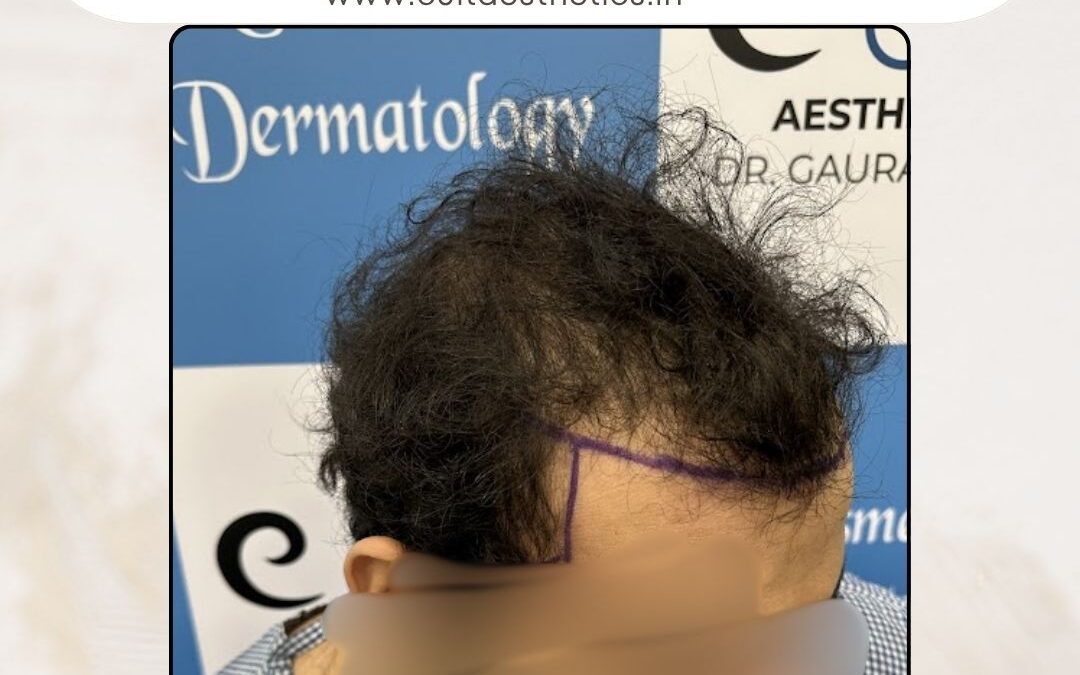 Hair Case 368 Before 4