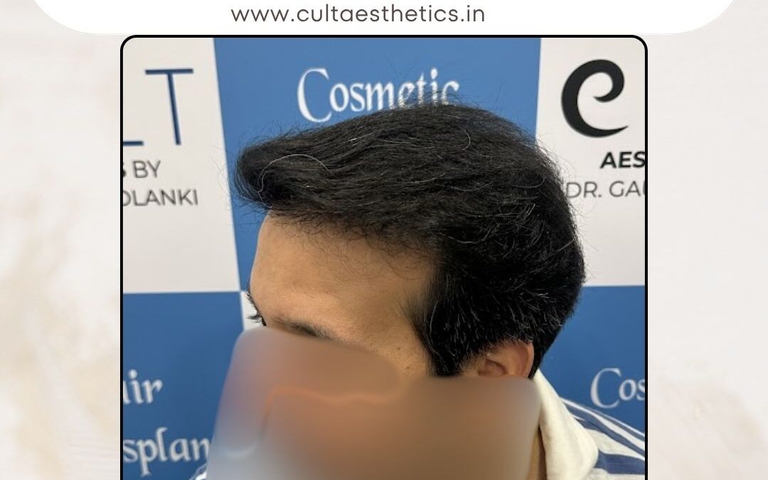 Hair Case 369 After 3