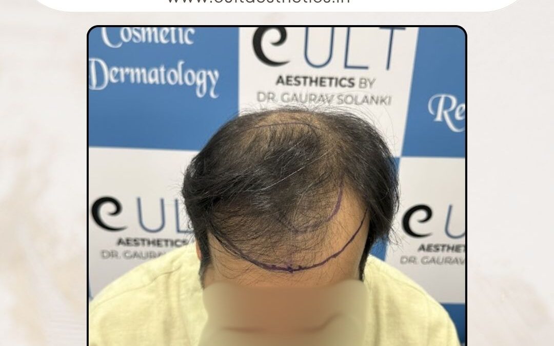 Hair Case 369 Before 2