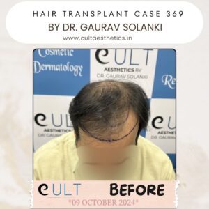 hair case 369 Before-2