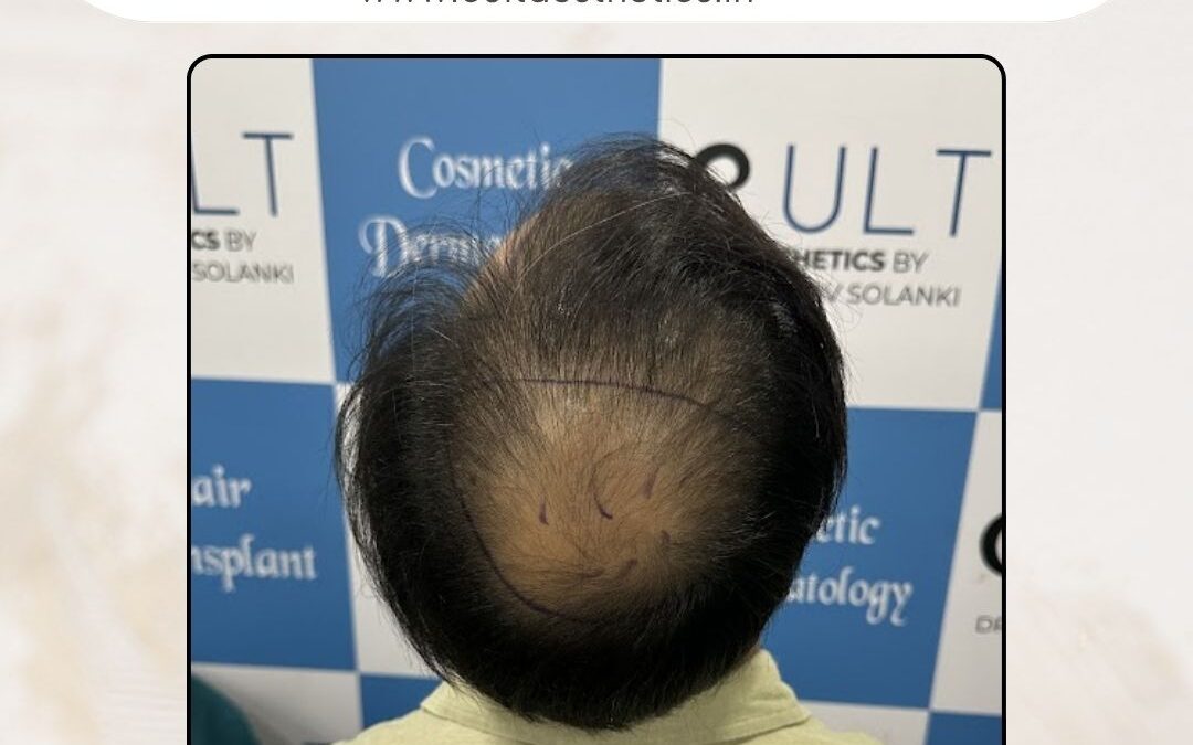 Hair Case 369 Before 3