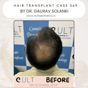 hair case 369 Before-3