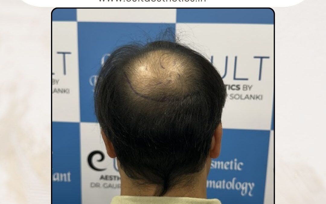 Hair Case 369 Before 4