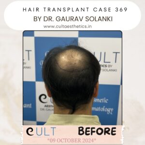 hair case 369 Before-4