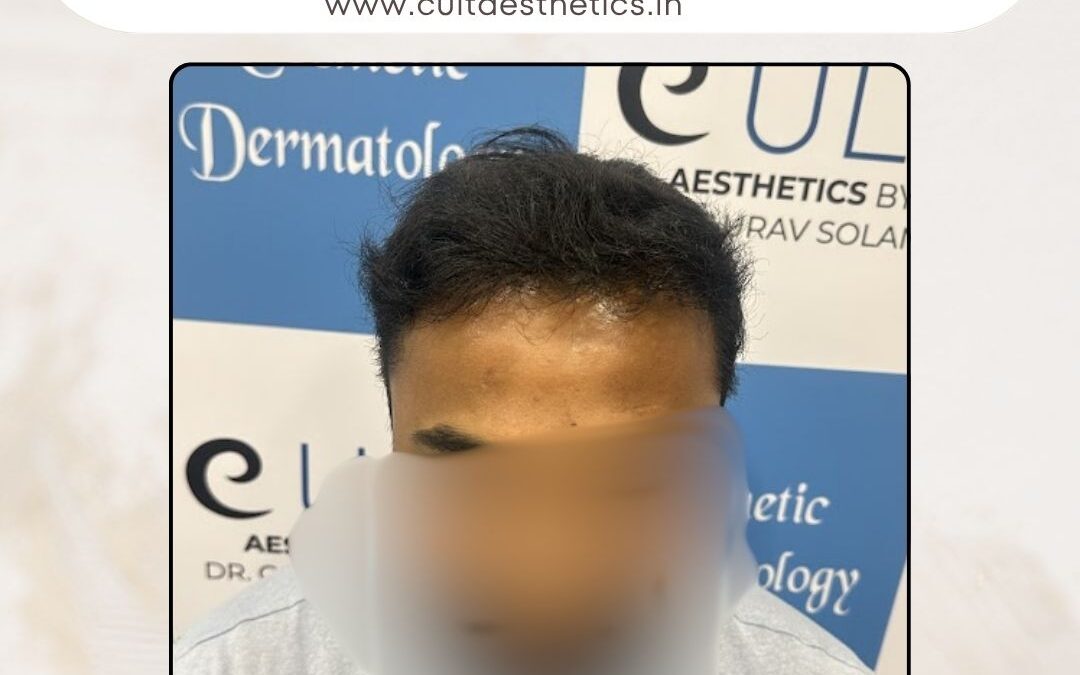 Hair Case 370 After 2