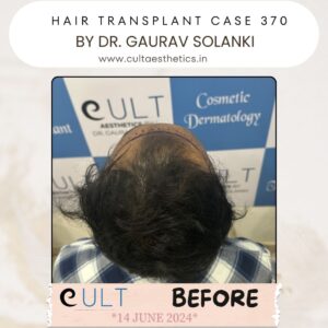 hair case 370 Before-3