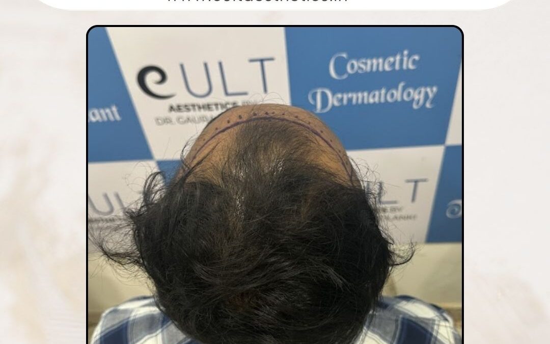 Hair Case 370Before 3