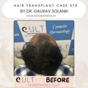 hair case 370Before-3