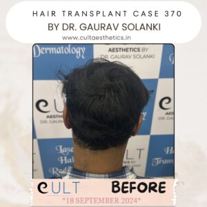 hair case 370Before-4