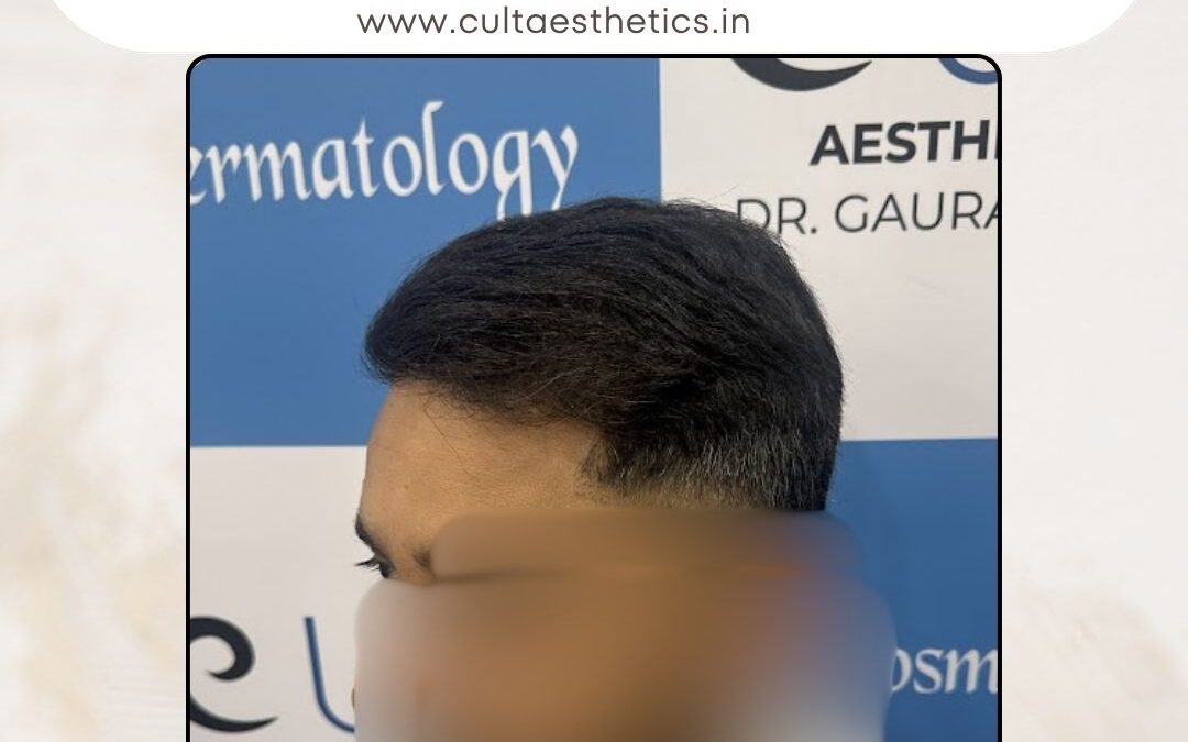 Hair Case 371 After 3