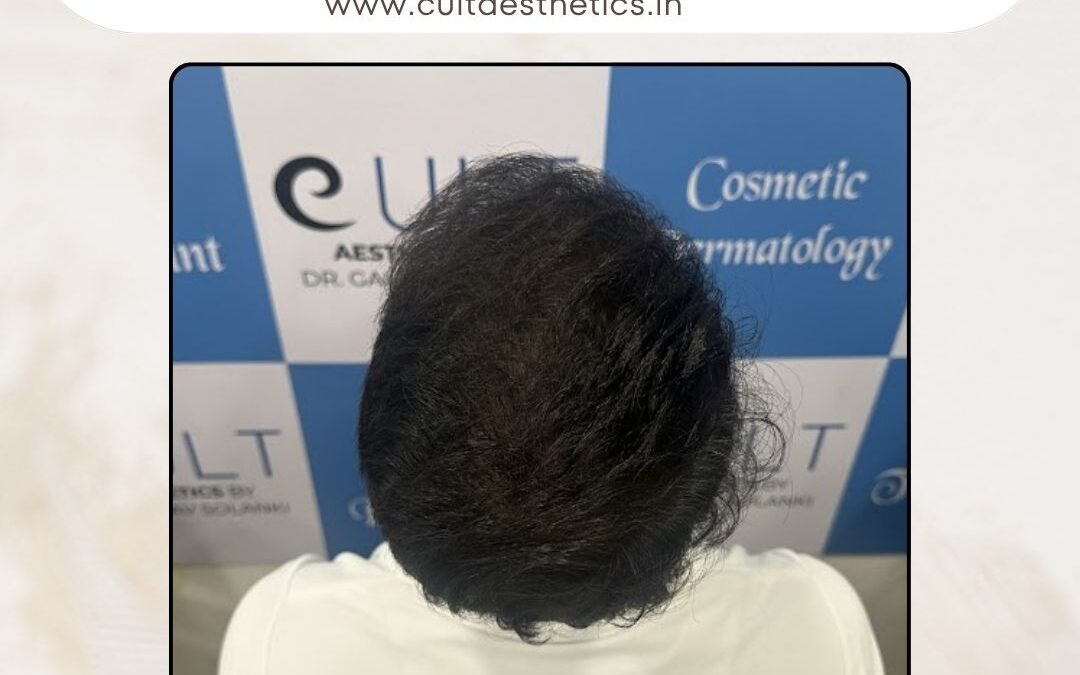 Hair Case 371 After 4