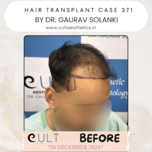 hair case 371 Before-2