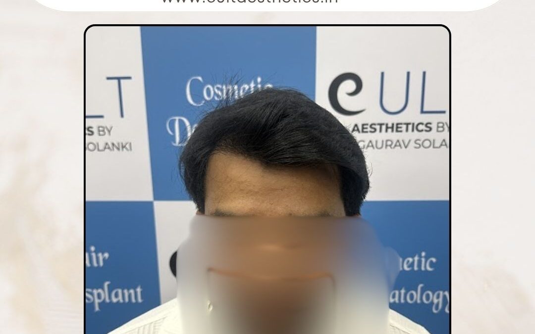 Hair Case 372 After 1