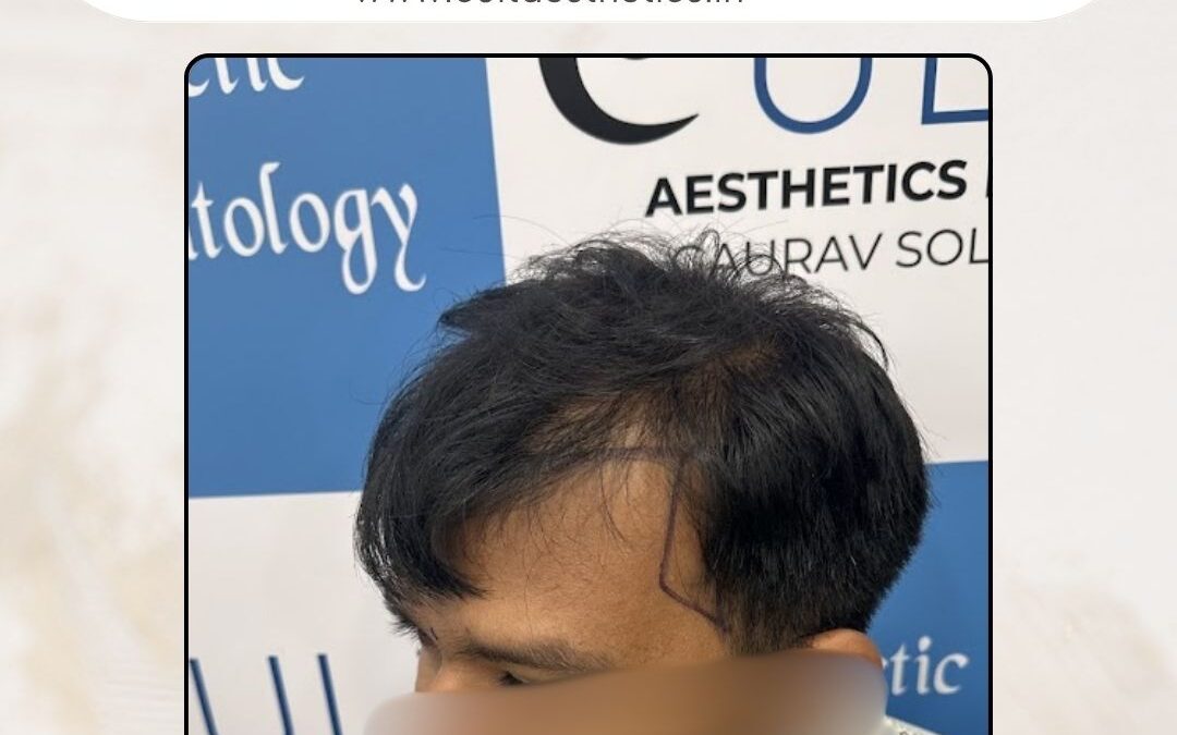 Hair Case 372 Before 3