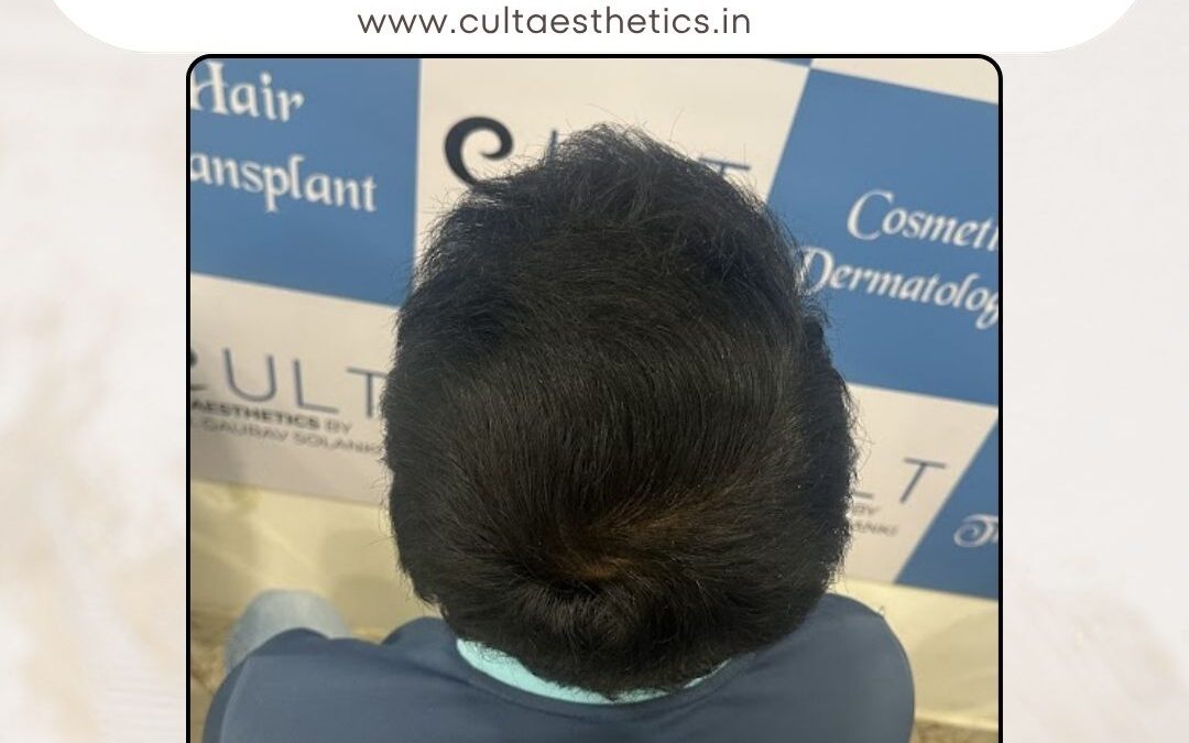 Hair Case 373 After 3