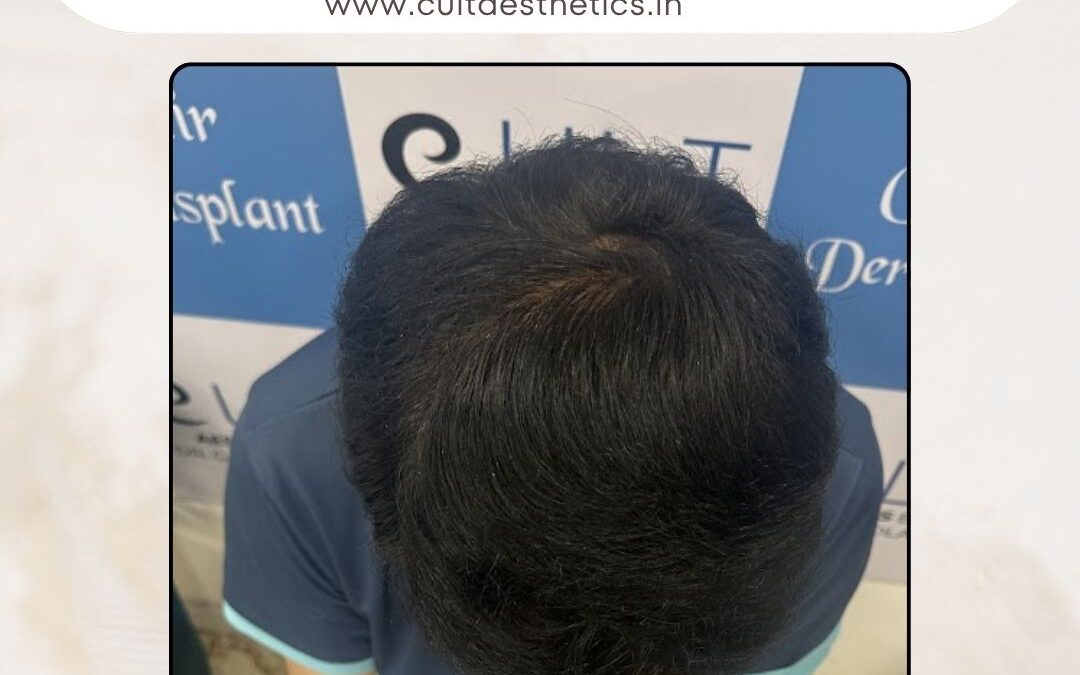 Hair Case 373 After 4