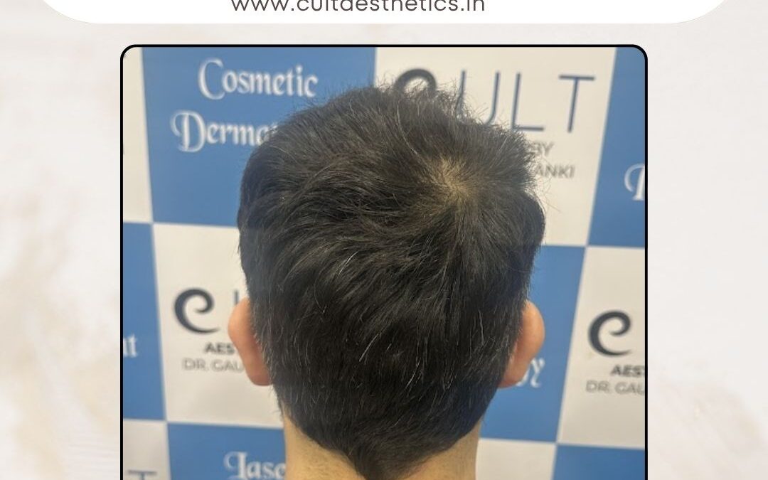 Hair Case 374 After 4