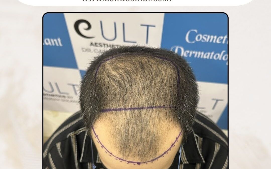 Hair Case 374 Before 2