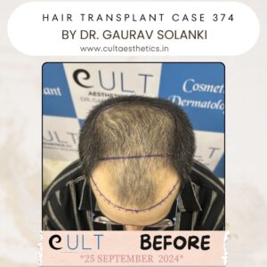 hair case 374 Before-2