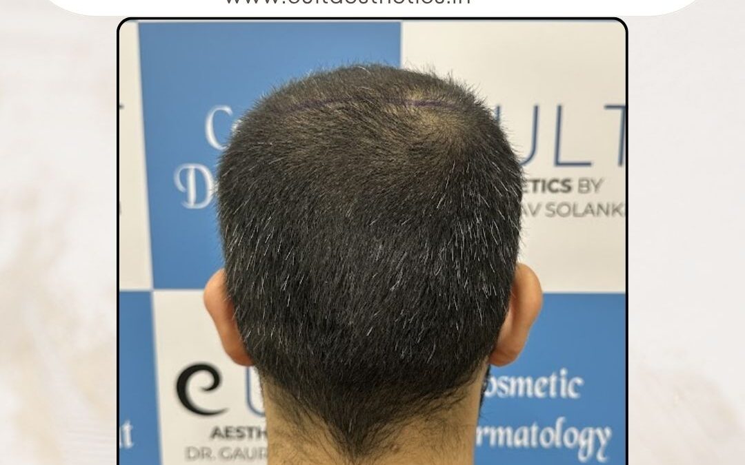 Hair Case 374 Before 4