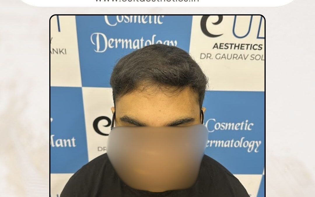 Hair Case 376 After 1